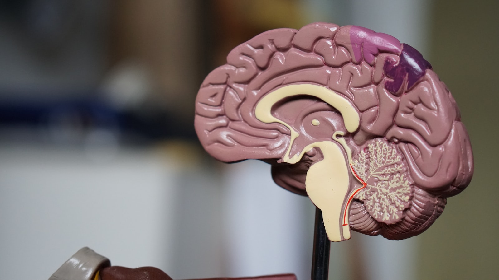 Brain Fog: A Functional Look at What Actually Causes It